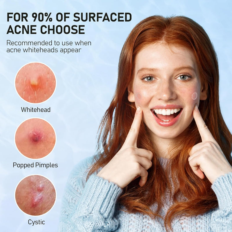 Pimple Patches for Face, 2 Sizes 192 Counts Acne Patches