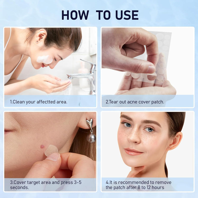 Pimple Patches for Face, 2 Sizes 192 Counts Acne Patches