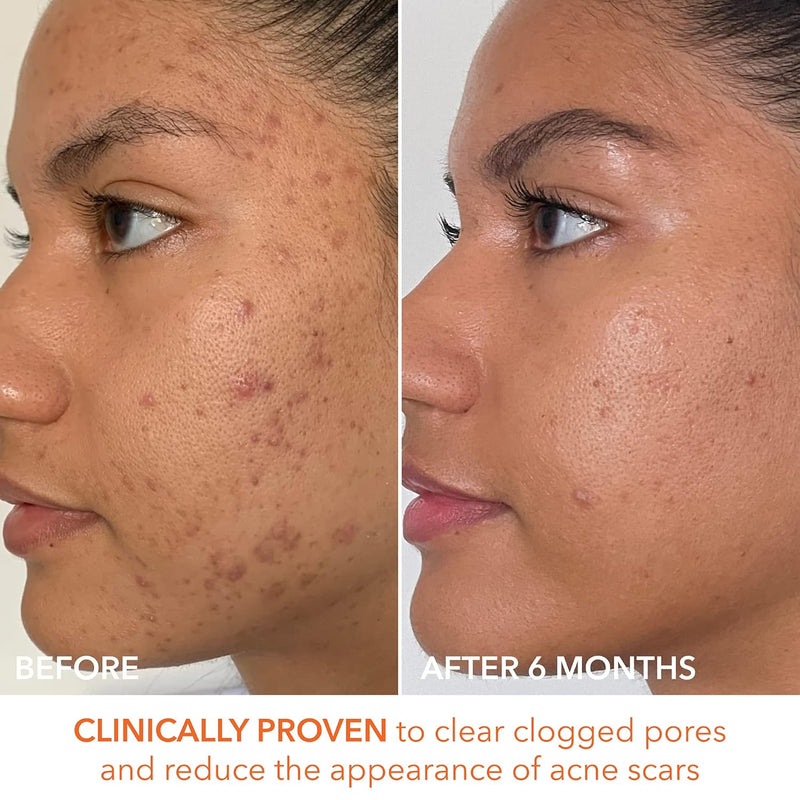 Dr. Dennis Gross Alpha Beta Extra Strength Daily Peel
